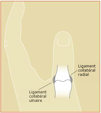 Entorse du pouce