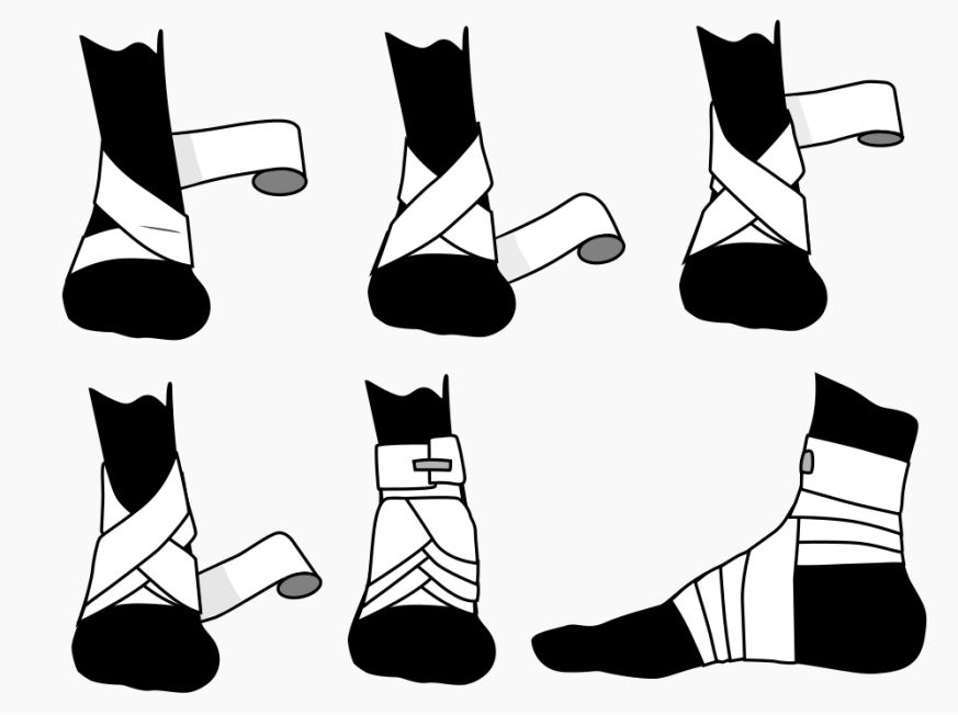 entorse
