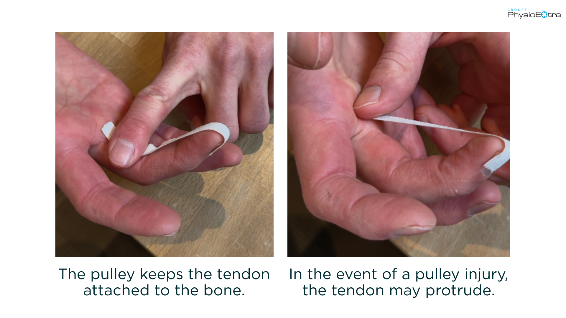 example of a finger pulley
